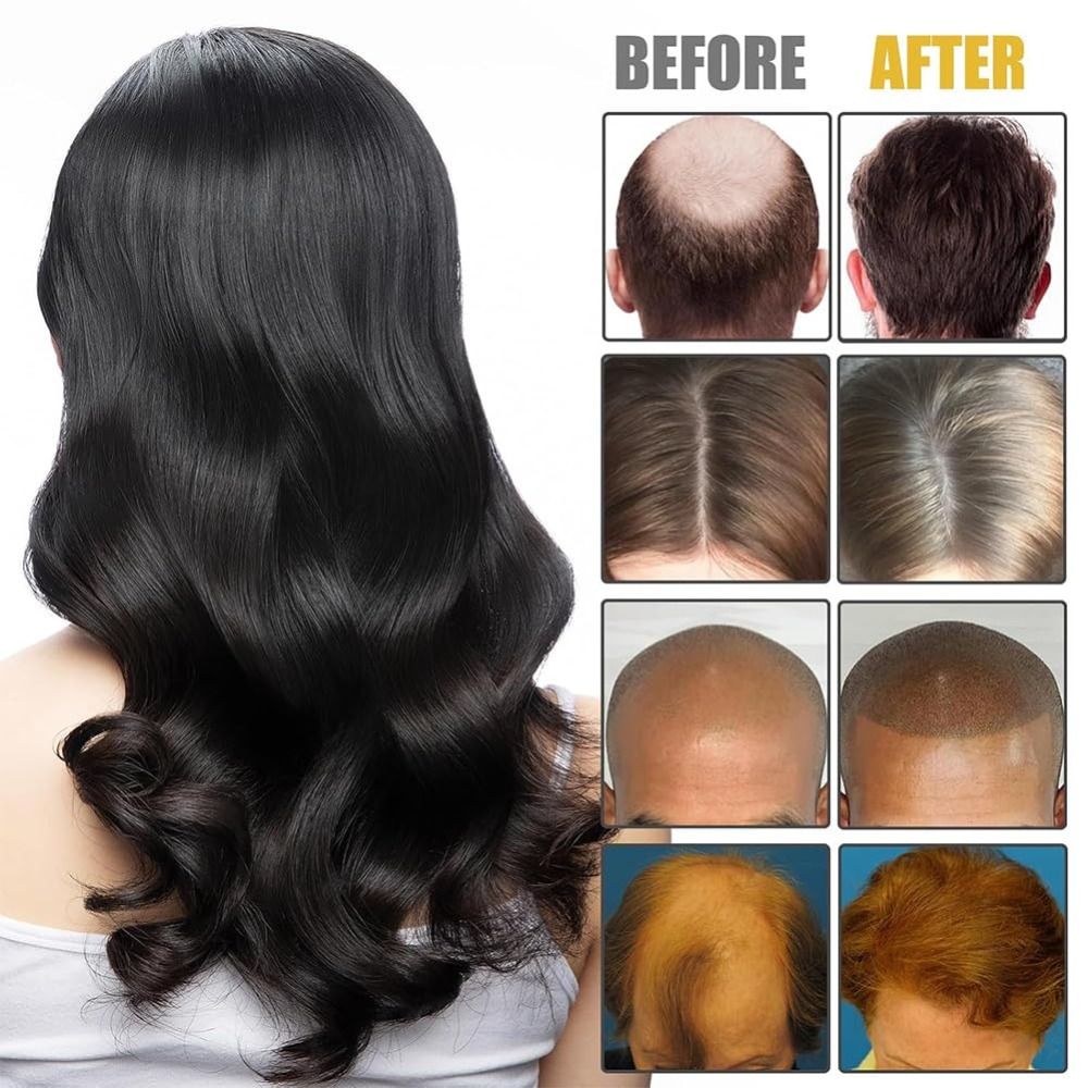 새로운 영양 공급 헤어 루트 볼텍스 콤 번들 4가지 설 - Hair Care Formulation 리뷰 및 가격